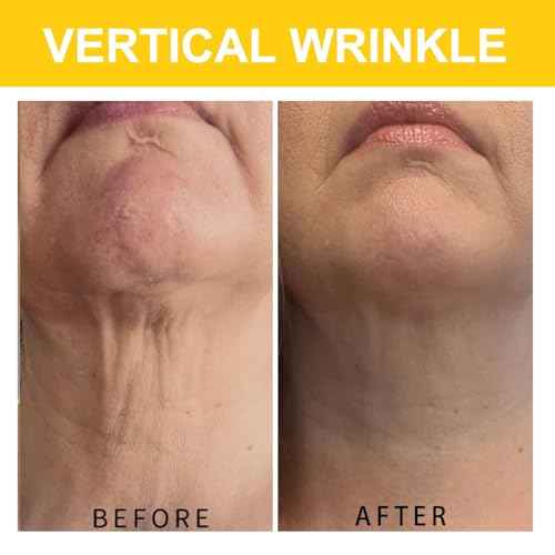 Neck Cream, Neck Creams for Tightening and Firming, Wrinkle Cream for Women, Skin Tightening Cream for Face, Neck, Chest & D?collet?.