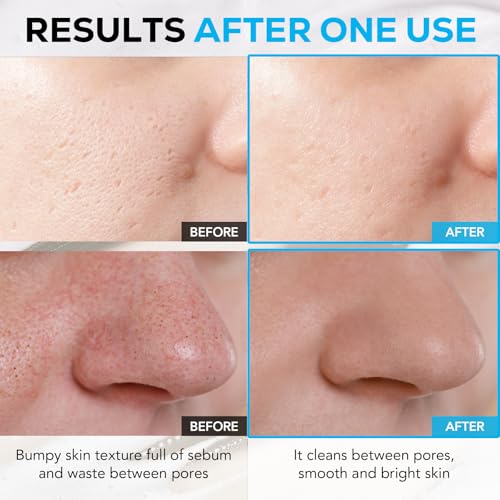 Olivia & Allison ZERO EFFECT CLEANSING FOAM 3.38fl oz (100ml) Natural BHA + AHA + Triple Eyaluronic Acid + Liposomal Cerasome for Gentle Exfoliation & Hydration