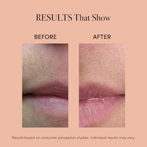 reVive Lux LED Lip Plumper | Red Light Therapy Device