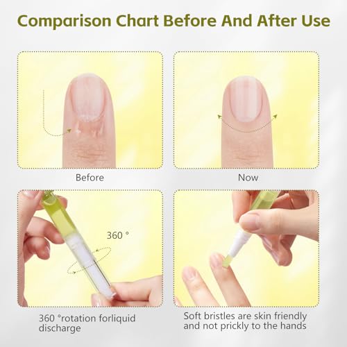 Grenben Radiant Nail Growth Oil Pens (4-Pack) - Strengthening Cuticle Care