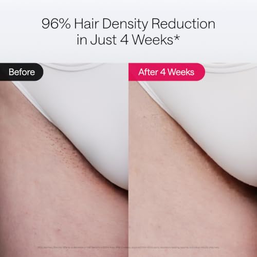 IPL Hair Removal Device for Women & Men, Painless Laser & SHR Technology, 10-Minute at-Home Hair Reduction