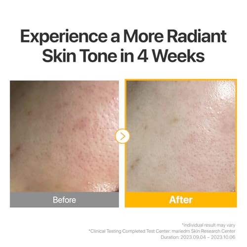 numbuzin No.5 Sheet Mask | Vitamin Spotlight Sheet Mask | Glutathione and Vitamin C | Reduces Hyperpigmentation, Improves Skin Complexion | Gentle and non-irritating | 5 sheet