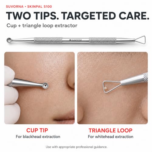 Suvorna 4-Piece Pimple Popper Tool Kit & Milia Extractor Set – Stainless Steel Acne Extraction Tools