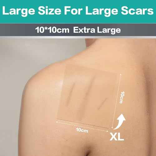 Medical Grade Silicone Scar Sheets, 20 Count (10x4 x4+10x1.2 x6) Dual-Size Scar Treatment for Surgical, Burn, Hypertrophic & Keloid Scars, Breathable & Discreet Strips