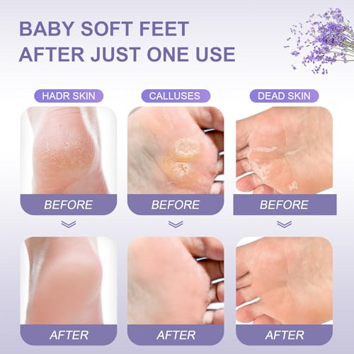 Exfoliating Foot Peeling Mask (5 Pack) - Natural Peel for Dry Skin & Calluses