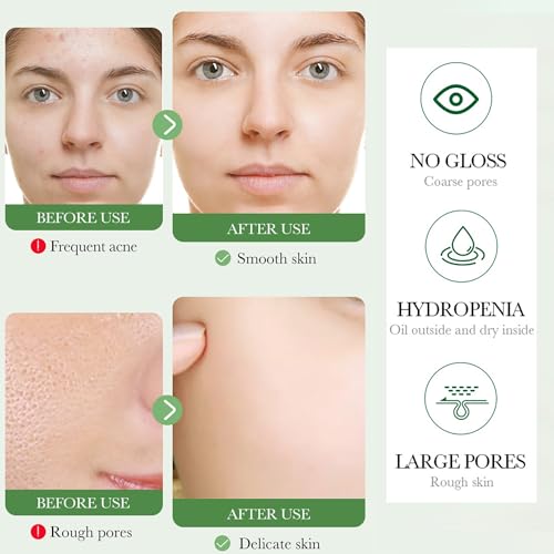 BIOAQUA Centella Asiatica Soothing Face Cleanser Oil Control Anti-Acne Deep Pore Clean Facial Hydrating Moisturizing 100g/3.5oz