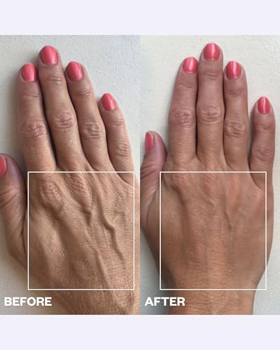Wrinkles Schminkles Reusable Silicone Hand Wrinkle Patches - 2 Pack