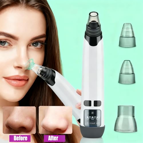 Blackhead Remover Pore Vacuum with Hot Compress, 69KPa Suction