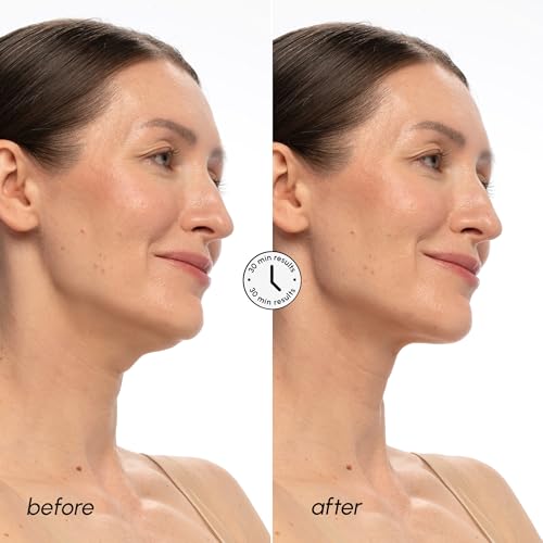 MAREE V Line Lifting Mask with PDRN Salmon DNA ? Deep Collagen Face Mask for Women ? Jawline Shaper Facial Masks with Retinol ? Tightening & Firming Neck Lift Tape ? Double Chin Strap for Face Lift