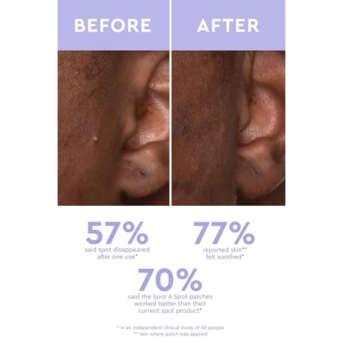 Acne Spot Patches by Florence by Mills Beauty