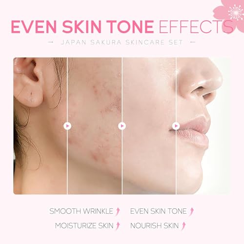SAKURA Skin Care Set, Skin Care Sets & Kits Women Girls Gift Set with Cleanser, Face Serum, Face Cream, Toner, Eye Cream, Travel Size Skincare Set for Women Teen Girls Birthday Christmas Gift (SAKURA)