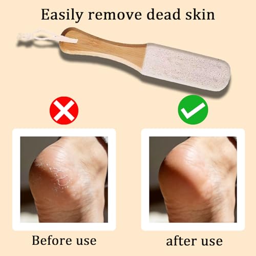 2-Pack Pumice Stone Foot File with Natural Bamboo Handle - Callus Remover