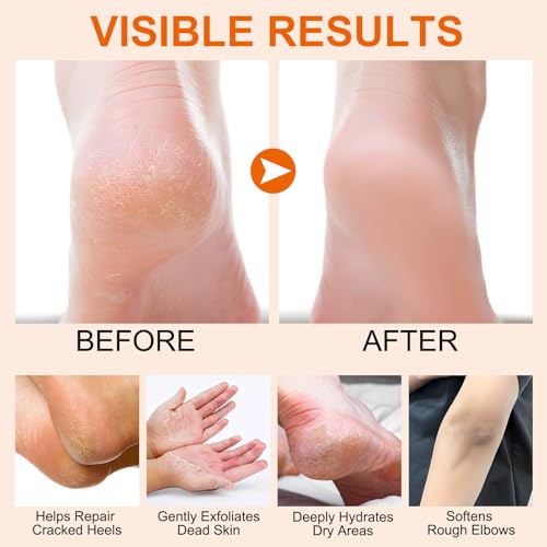 Manuka Honey Moisturizing Stick for Dry Feet & Elbows