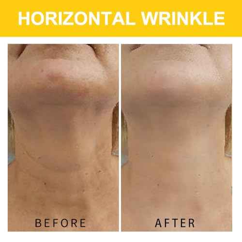 Neck Cream, Neck Creams for Tightening and Firming, Wrinkle Cream for Women, Skin Tightening Cream for Face, Neck, Chest & D?collet?.