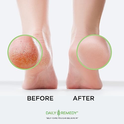Daily Remedy Extra Strength Tea Tree Oil Foot Soak with Epsom Salt - 16 oz
