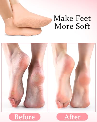 2 Pairs Silicone Moisturizing Socks for Dry Cracked Feet - XL Fit