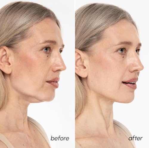 MAREE V Line Lifting Mask with Retinol & Hyaluronic Acid
