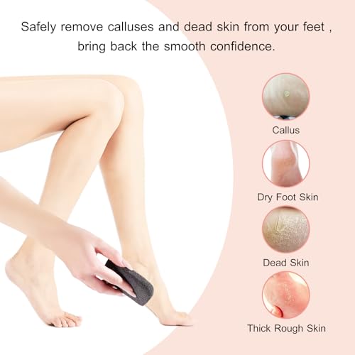 Natural Volcanic Pumice Stone Set for Feet - 3 Shapes Callus Remover