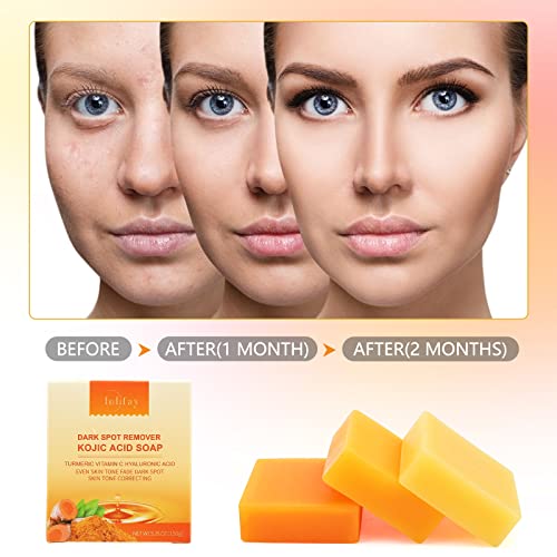 Inlifay Kojic Acid Soap with Turmeric: Dark Spot Remover Soap with Vitamin C, Vitamin E, Retinol, Collagen, Hyaluronic Acid, Moisturizing for Body & Face Pack of 2