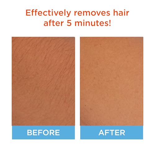 Sally Hansen Hair Removal Cream for Face, 1.7 Fl Oz + Aftercare Lotion - Vegan, Fast-Acting Facial Depilatory with Sweet Almond & Shea Butter, Pack of 1