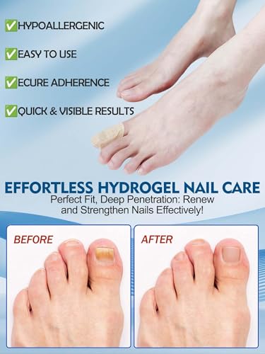 Extra Strength Overnight Nail Repair Patches for Damaged Nails - 48 Pack