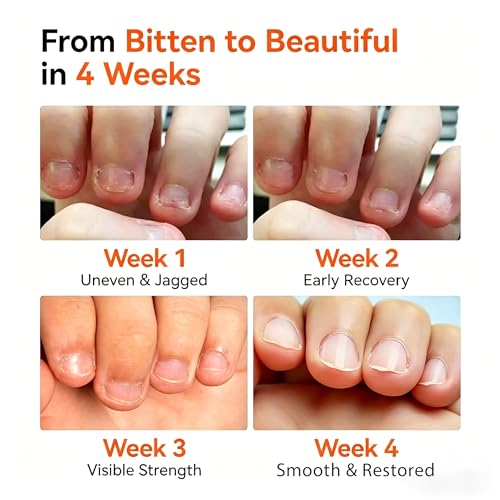 Modelones Anti Nail Biting Polish & Bitter Thumb Sucking Deterrent, 0.48 fl oz