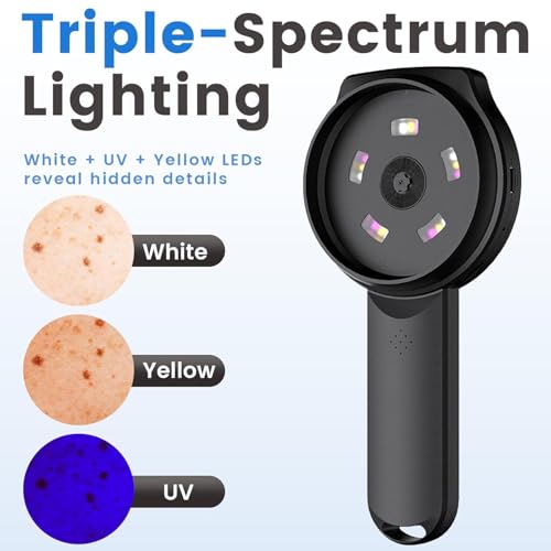 Digital Dermatoscope Skin Analyzer with 2.8" IPS Screen & 500X Magnification