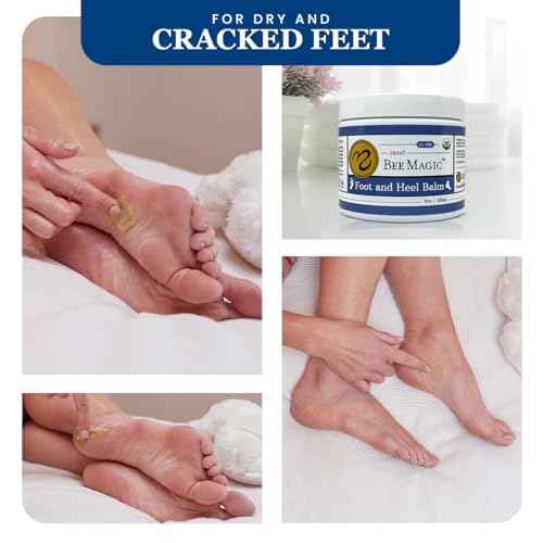 Sweet Bee Naturals Organic Foot and Heel Balm ? All Natural Moisturizing for Dry, Cracked Feet, Heel Care & Callus Treatment ? Repair & Soften Rough Skin ? Made in USA ? 4 OZ Jar