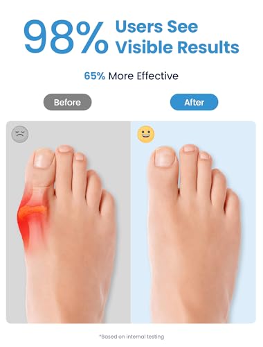 Bunion Corrector Gel Toe Separators - Reusable 4 Pack for Alignment