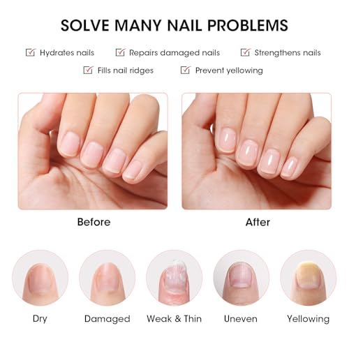 GELLEN 3-in-1 Clear Ridge Filling Base Coat & Nail Strengthener (HEMA Free)