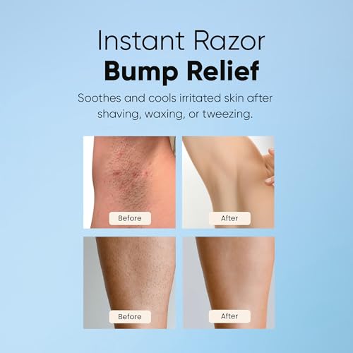 ESTETIST Razor Bump Roll-On – Ingrown Hair & Post-Shave Care