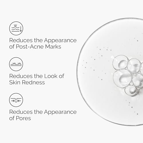 The Ordinary Aloe 2% + NAG 2% Solution, Soothes Skin and Targets Post-Acne Marks, 1 Fl Oz
