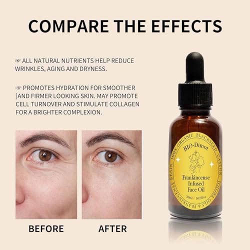 90 ML Frankincense Essential Oil,Castor and Jojoba Oils Frankincense Resin Oil for Face Moisturizer Cold Pressed Anti-Aging Serum.(3 Pcs)