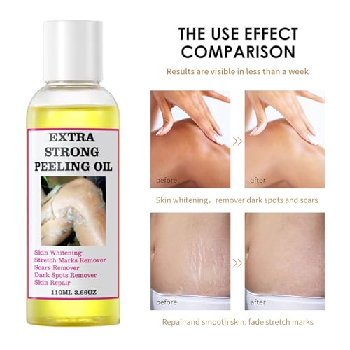 Yellow Peeling Oil for Dark Skin, Extra Strong Peeling Oil, Natural Formula Exfoliating Peels Solution for Face, Body, Hands and Foot Dead Skin Remover (110ml)