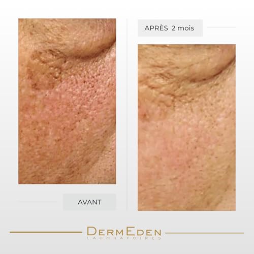 DERMEDEN NIGHT PROTOCOLE INTENSE ANTI-AGEING EYE CONTOUR CREAM 15ML ¡¦