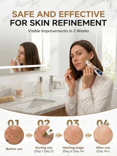Plasma Skin Tag Remover Pen with 9 Speed Levels, USB Rechargeable