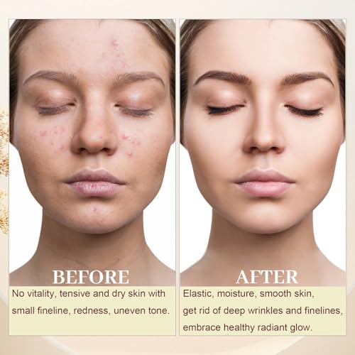 3 Pack Gua Sha Face Oil for Women, Rosehip Oil Organic Facial Oil Moisturizer Infused Rose, Vitamin E & C, Restore and Rejuvenate, Hydrating Facial Oil for Dermaplaning, 1.01fl.oz/30ml