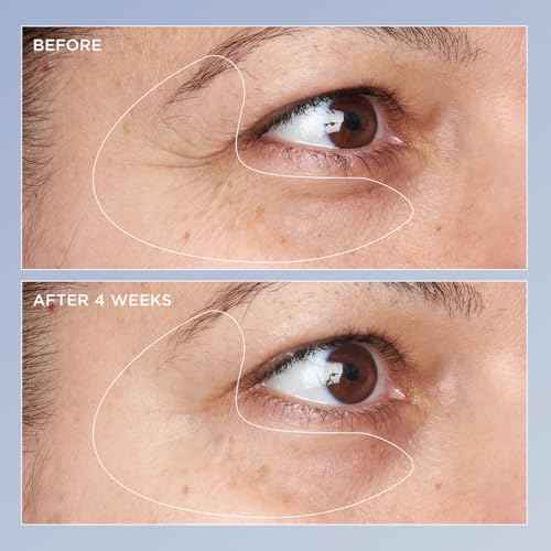 Perricone MD High Potency Triple Retinol Renewal Eye Serum, 0.5 fl. oz.