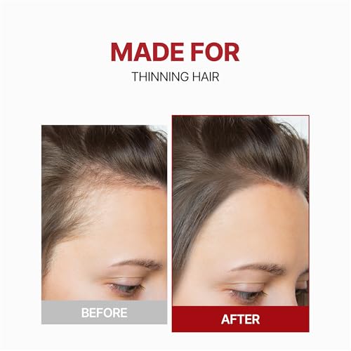 KUNDAL Root Enhancer Caffeine Scalp Tonic Herb Mint - 3.38 Fl Oz - B. Caffeine Scalp Treatment