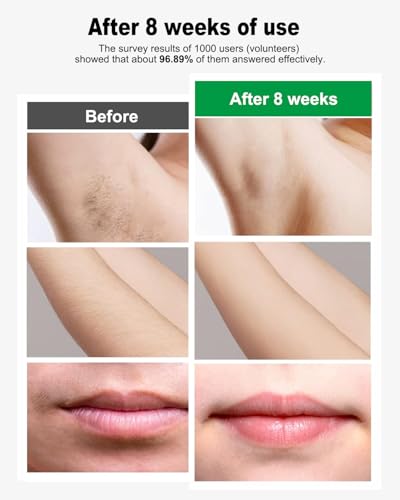 IPL Hair Removal Device for Women and Men - Green - Permanent Laser System