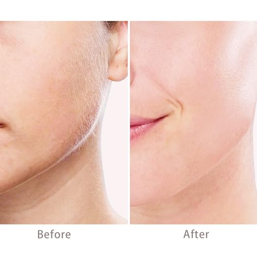 Replacement Heads for Flawless Generation 3 Hair Remover - 6 Pack