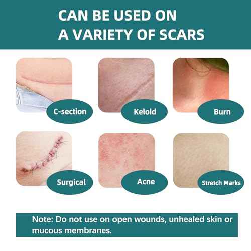 Silicone Scar Gel Sheets: Medical Grade Scar Tape for C Section Surgical Tummy Tuck Keloid Treatment?Scar Removal for Face and Skin