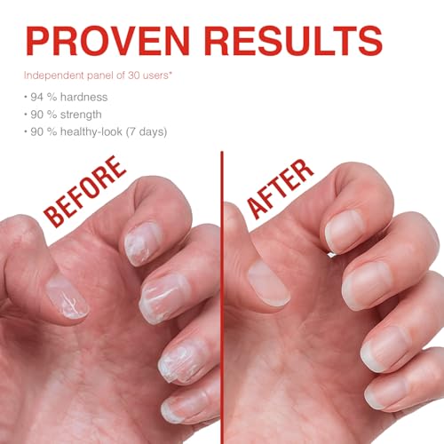 Probelle Nail Strengthener - Repair & Growth Treatment