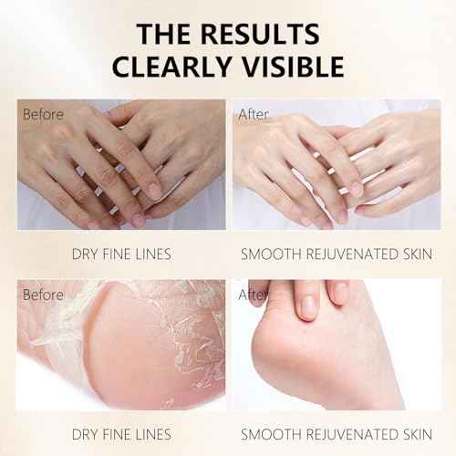 Hydrating Hand Foot Masks Set for Women Men,6 Pack Glove Mask for Dry Hand & 6 Pack Socks Mask for Dry Cracked Feet£¨Milk£©