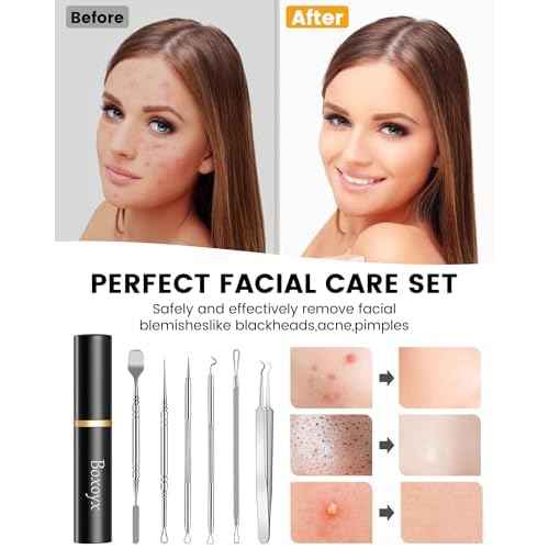 Pimple Popper Tool Kit - Boxoyx 6 Pcs Pore Prep Blackhead Remover Comedone Extractor Kit with Box for Quick and Easy Removal of Pimples, Blackheads, Zit Removing, Forehead,Facial and Nose (Silver)