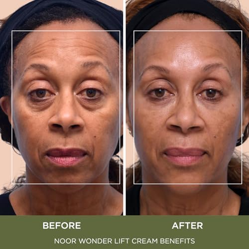 Noor Wonder Lift Anti-Aging Cream for Women – Reduces Wrinkles Fast, Natural Skin Care