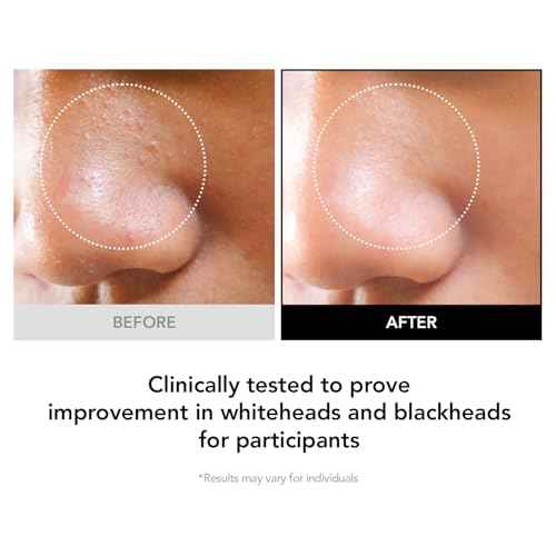 98% Reduction in Pore Impurities & 92% Less Sebum ? Improves Blackheads & Whiteheads by 36% ? Soothes & Strengthens Skin Barrier with D-Panthenol ? Korean Skincare Best Cleansing Foam
