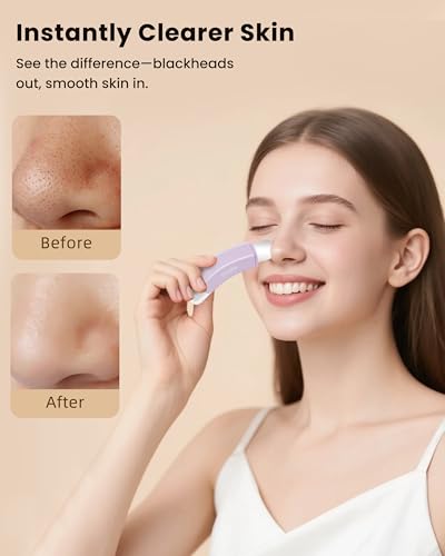 Boloye Dual-Head Blackhead Remover Scraper Tool