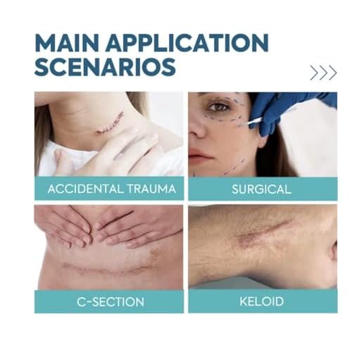 Silicone Scar Sheets 1.6" x 120" - Medical Grade, Long-Lasting, Reusable Tape Roll for C-Section, Surgical Scars, Keloid, Acne, Tummy Tuck Recovery & Wrinkle Treatment