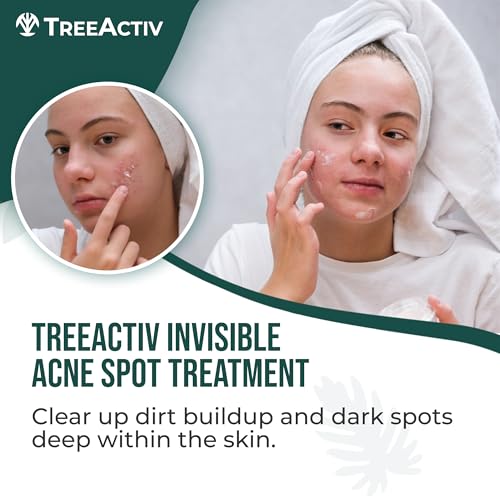 TreeActiv Invisible Salicylic Acid Spot Cream, Original Formula Lightweight Face & Body Cream for Acne-Prone Skin, Daily Use for Teens & Adults, Clear-Drying, Gentle Formula, 0.5 fl oz